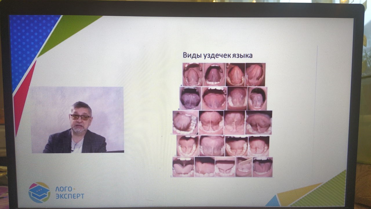 фото уздечки языка